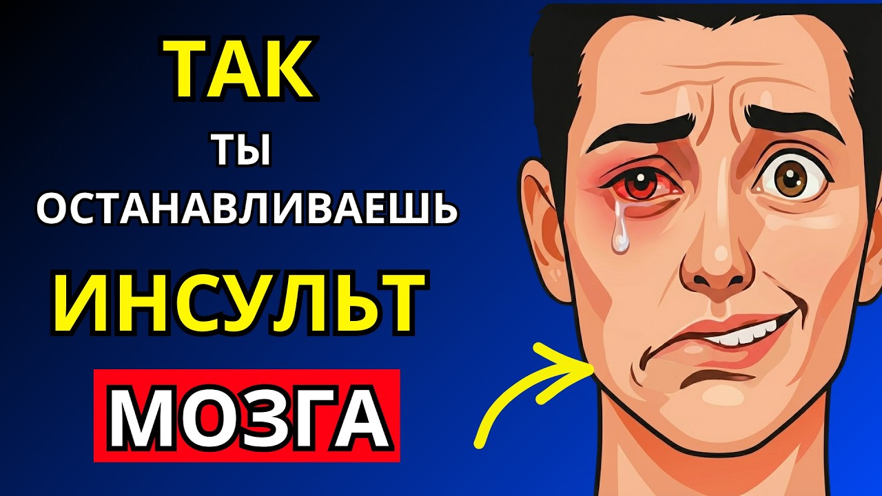 ИНСУЛЬТ: У ВАС ЕСТЬ 3 ЧАСА, ЧТОБЫ СПАСТИ МОЗГ (ПРОТОКОЛ FAST)