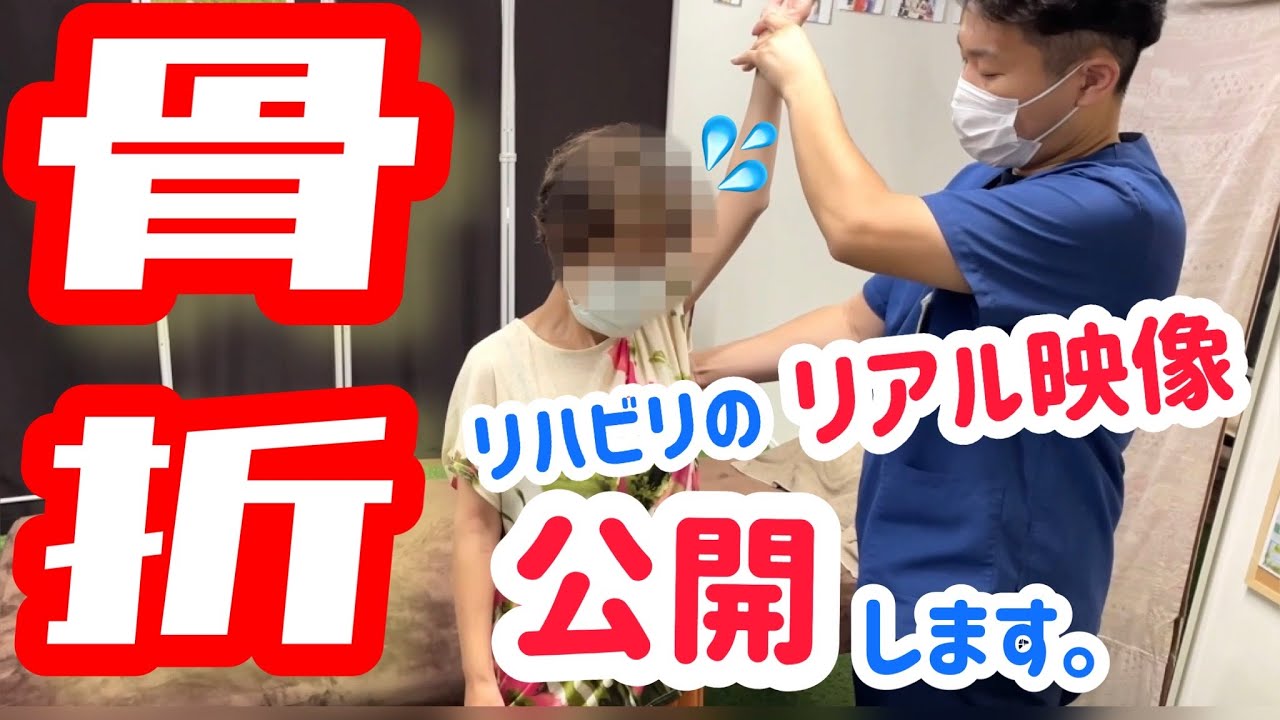 【公開】骨折のリハビリ映像！骨折を早く治す方法！腕の骨折リハビリのリアル映像！