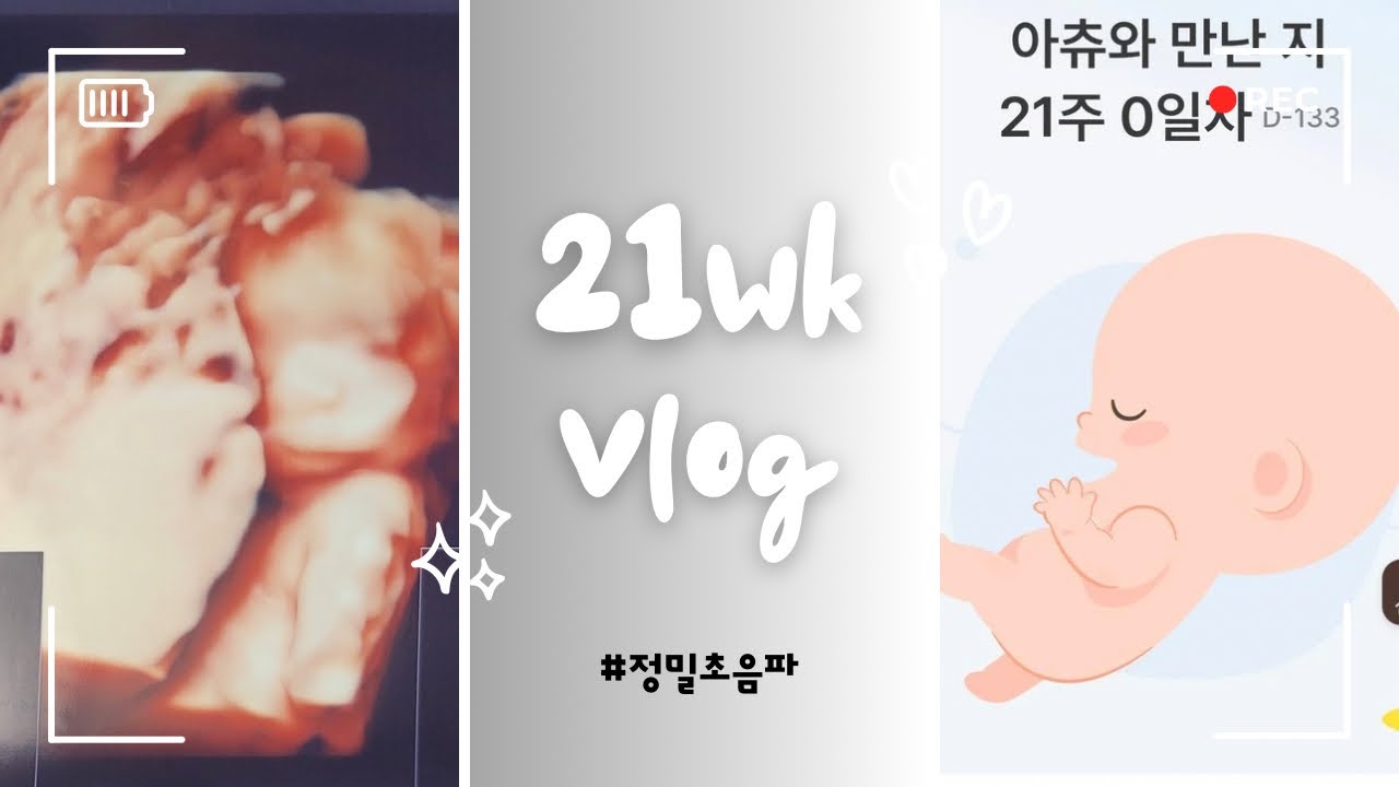 21wk pregnancy vlog | 정밀초음파, 아기 얼굴 보고 왔어요!