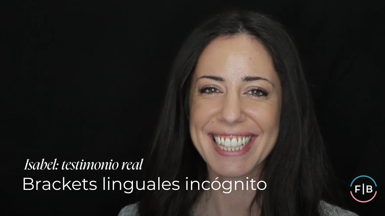Experiencia de tratamiento de ortodoncia con brackets linguales | Ferrus & Bratos