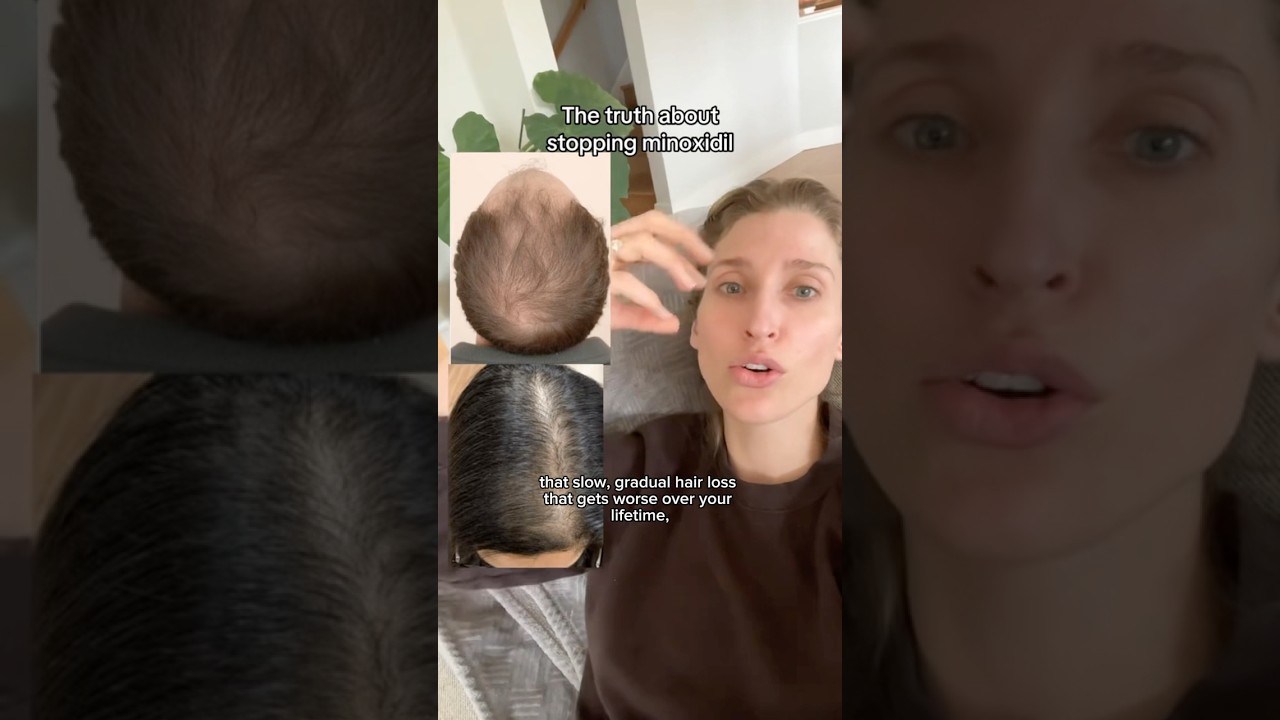 This #hairloss myth needs some clarification!