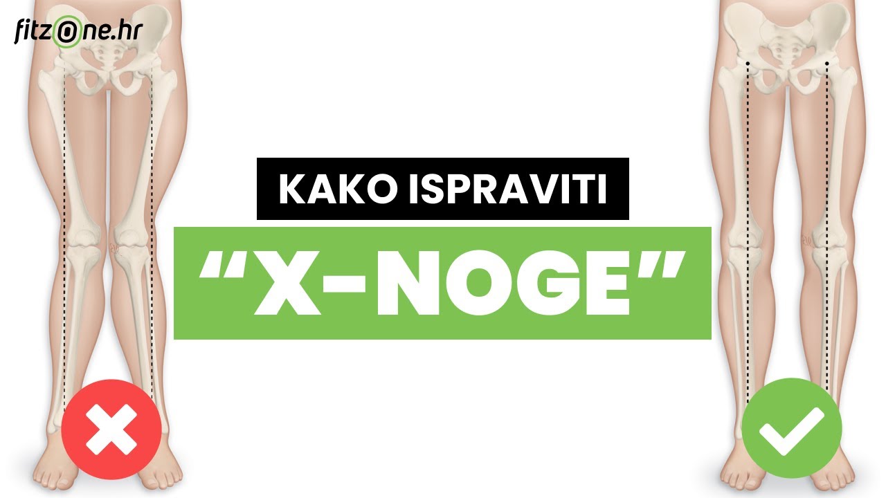 Kako ispraviti 