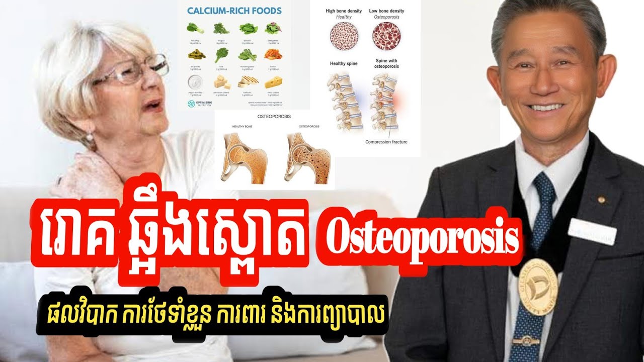 រោគស្ពោតឆ្អឹង Osteoporosis | ផលវិបាក ការថែទាំខ្លួន ការពារ និងការព្យាបាល