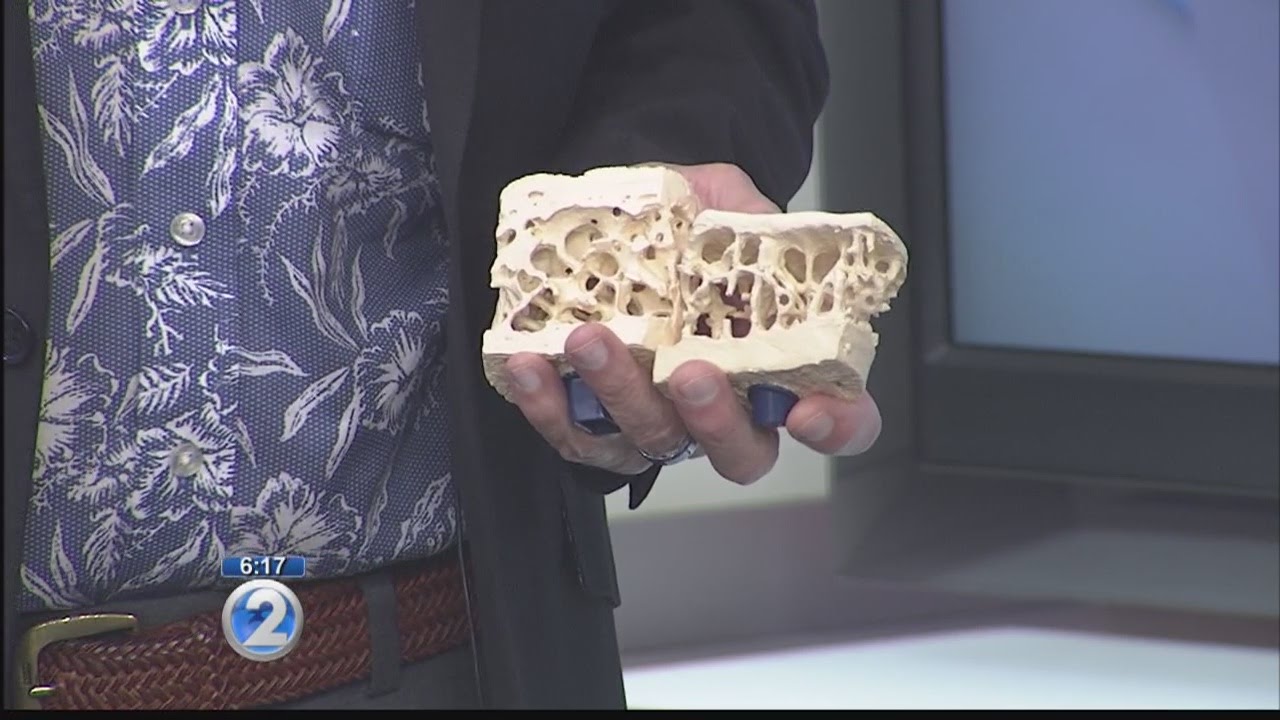 &ldquo;Osteoporosis and Better Bone Health&rdquo; &ndash; The Queen&rsquo;s Medical Center &ndash; Ask a Specialist