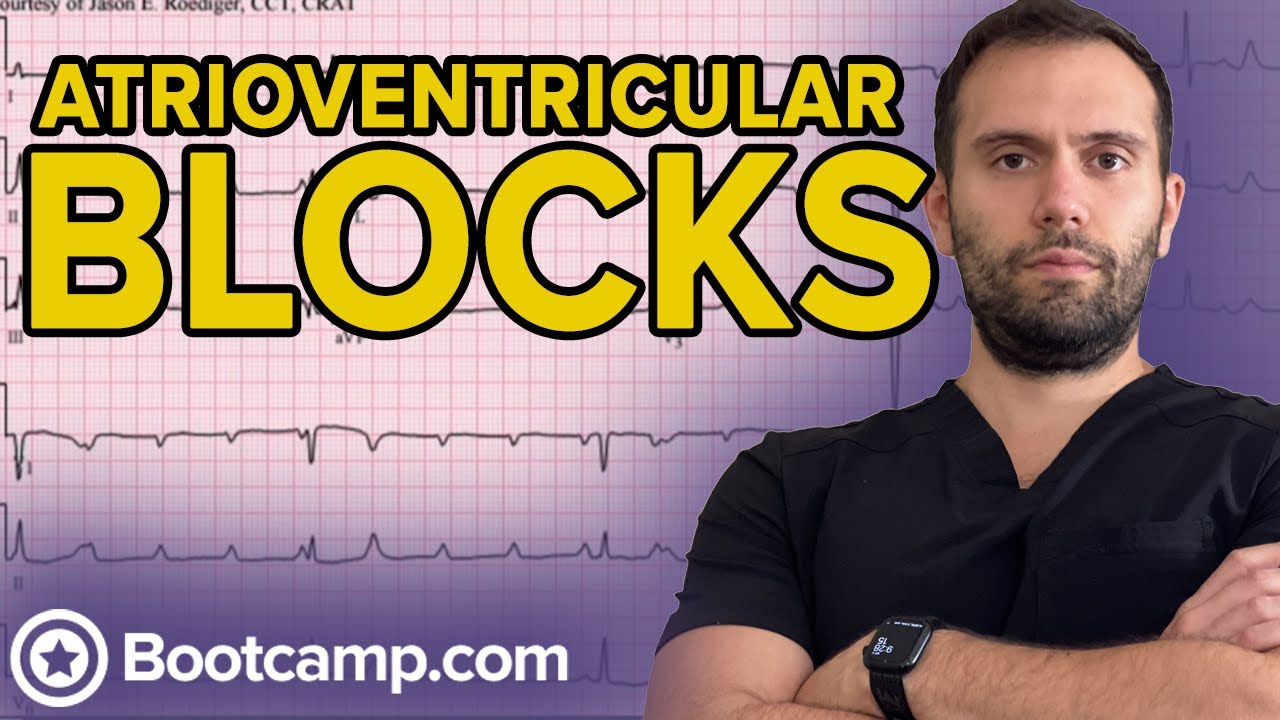 Conduction Blocks - Atrioventricular Blocks | HIGH-YIELD CARDIOLOGY | USMLE STEP 1