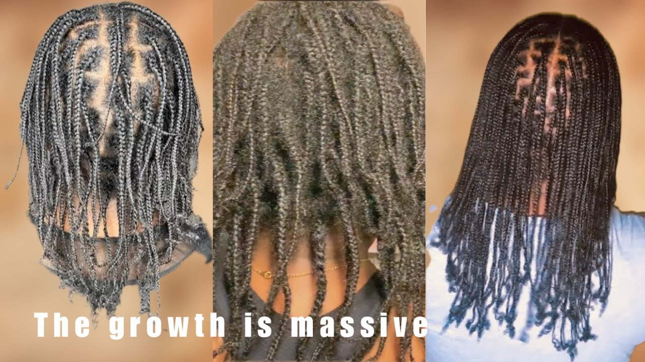 The Growth Is Massive In Just One Month/Natural hair Growth 😱