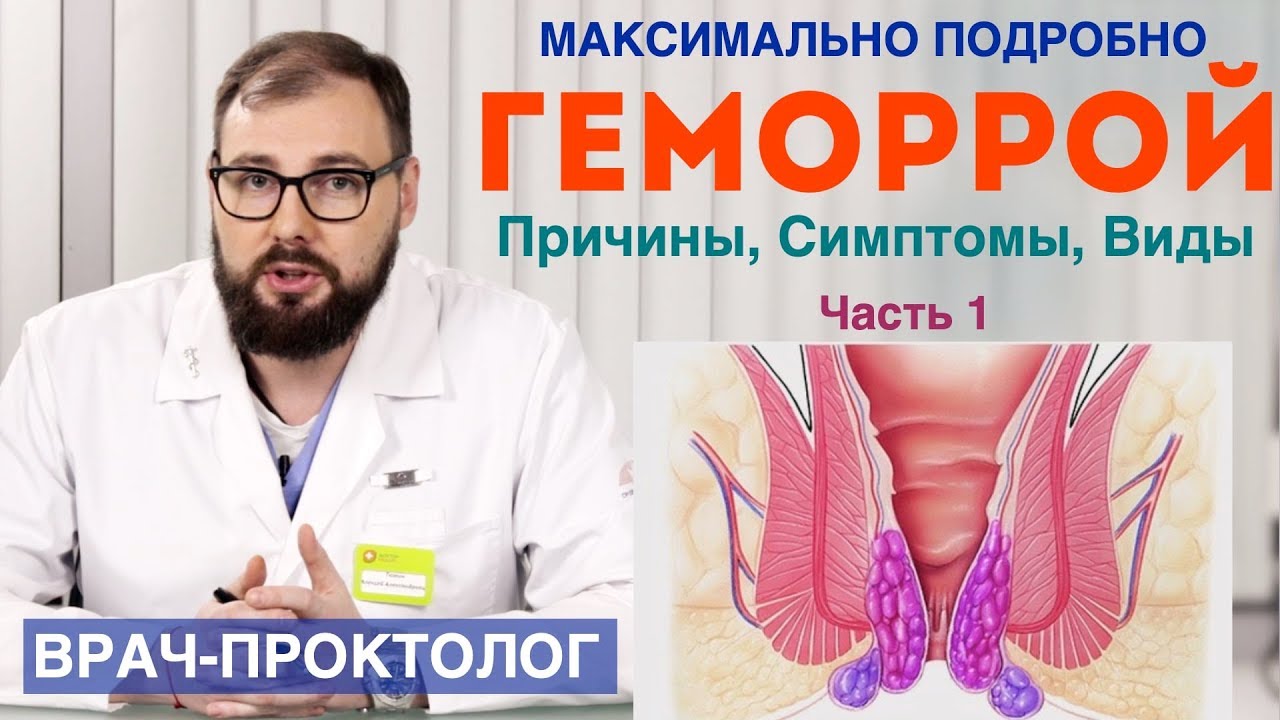 Геморрой - причины, симптомы, стадии и виды геморроя.