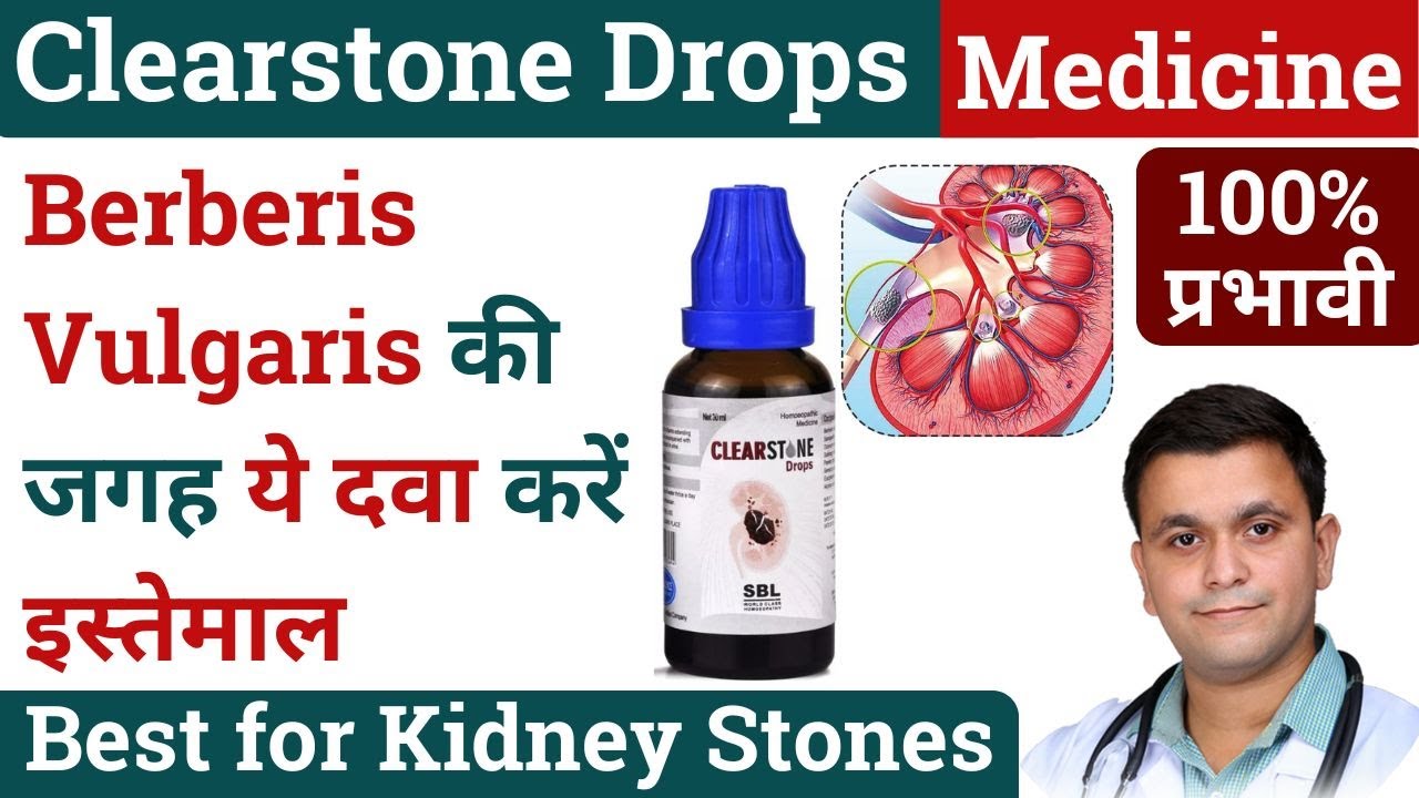 Clearstone drops vs Berberis Vulgaris Homeopathic Medicine Berberis Vulgaris Q Clearstone drops SBL