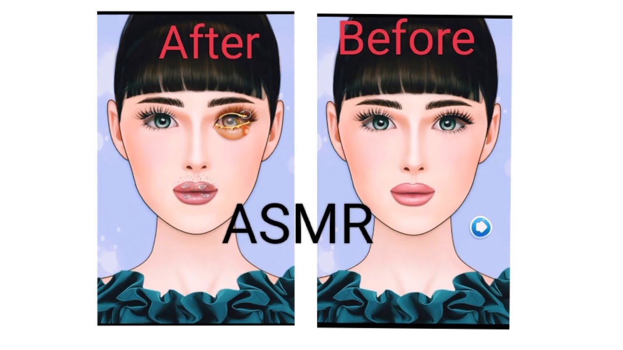 Asmr | Eye treatment by animation