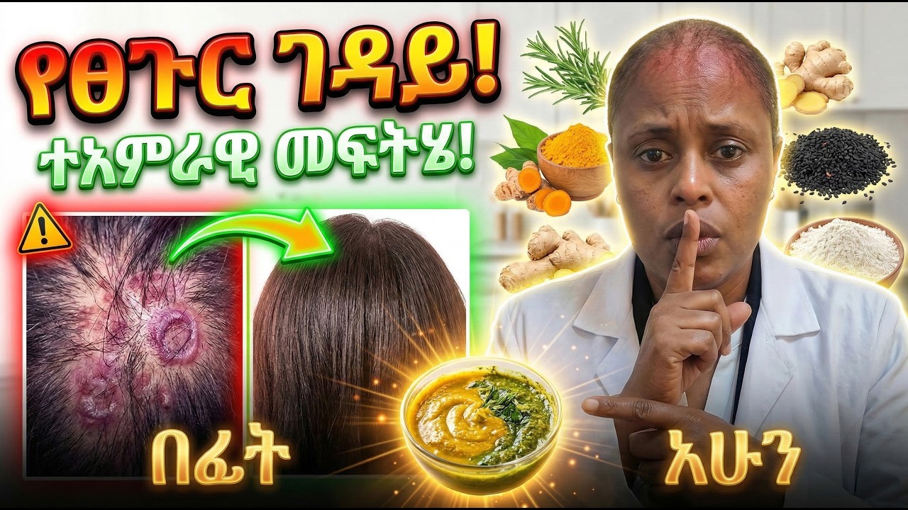 ፀጉርዎ ለምን ይረግፋል? ከችግሩ መንስኤ እስከ ተአምራዊው መፍትሄ |@yenetena