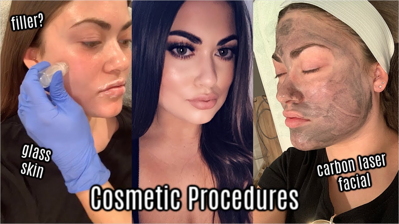All About My COSMETIC PROCEDURES 💉AquaGold, Lip Filler & More