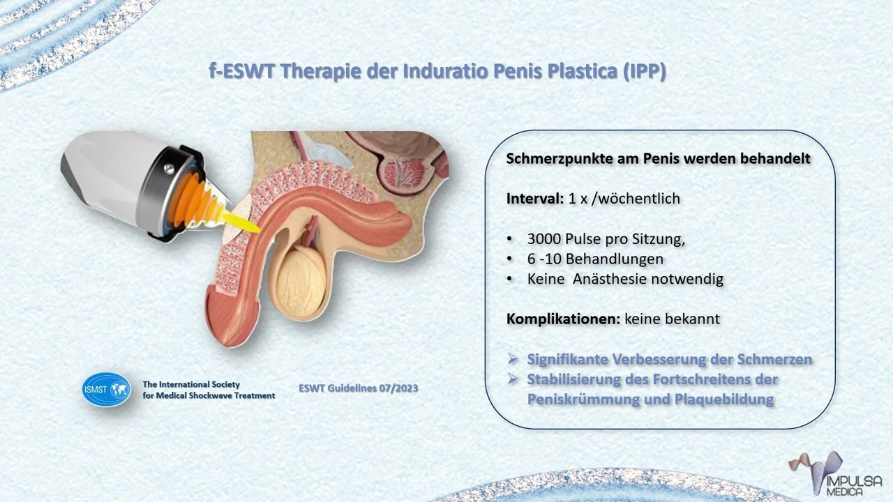 Sto&szlig;wellentherapie in der Urologie und Andrologie
