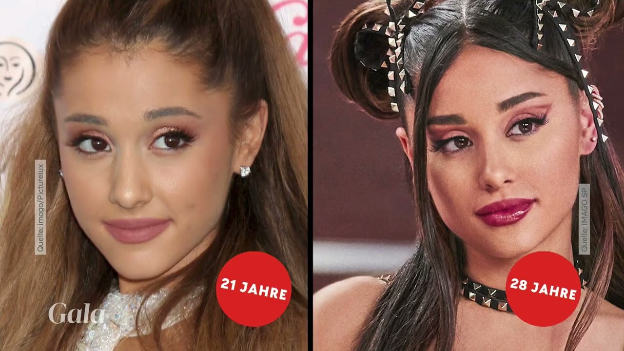 Ariana Grande Gesichtsanalyse: Früher vs. Heute | Fachärztin Olga Ludewig