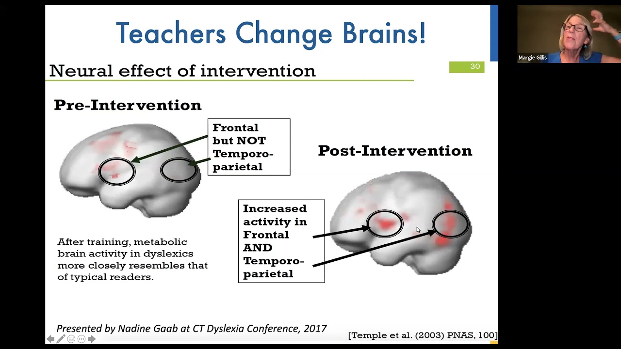 Why Bring the Science of Reading & Structured Literacy into the Classroom: A Talk w/ Margie Gillis