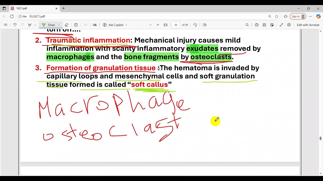 Lic2 part 2  repair  (repair of bone fracture )