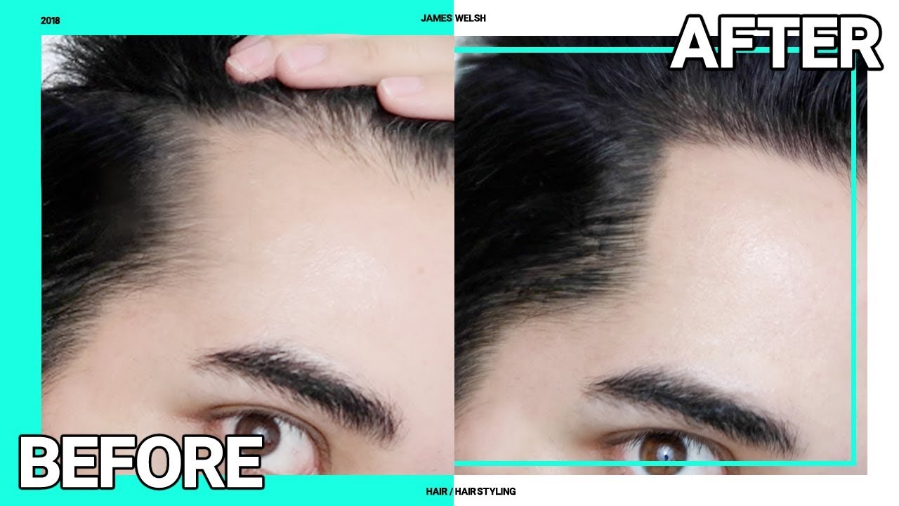 Instant Fix For Receding Hairline / Thinning Hair - Hair Makeup  ✖ James Welsh