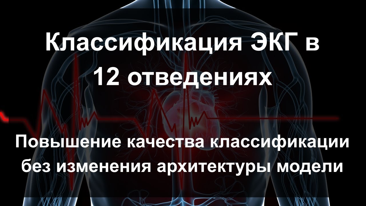 Классификация ЭКГ в 12 отведениях. Повышение качества классификации без изменения архитектуры модели
