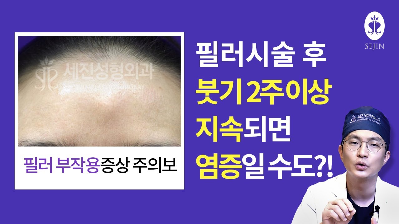 필러시술 후 붓기 2주이상 지속되면 염증일 수도?! 이런 필러부작용증상 주의하세요!