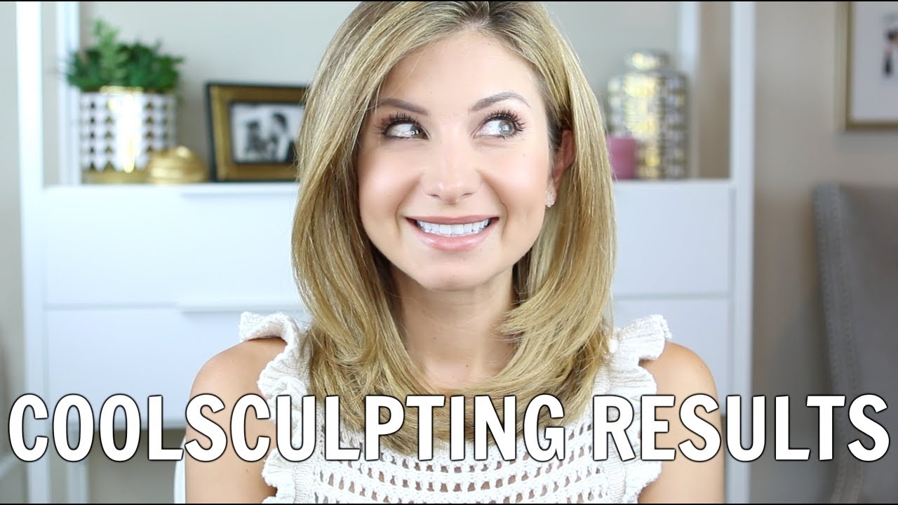 My COOLSCULPTING Results | BEFORE & AFTERS