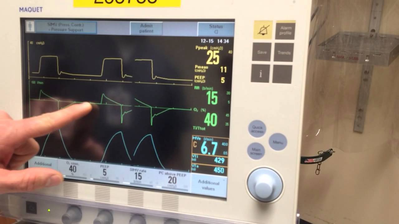 How to set inspiratory time without an order