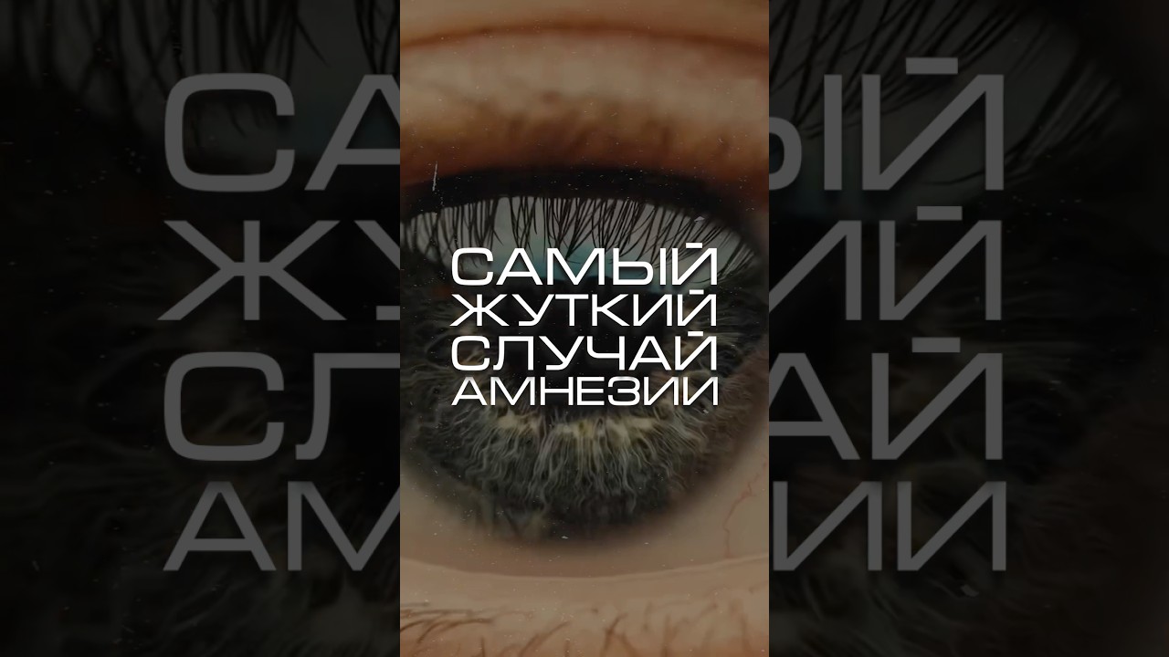 Самый жесткий случай амнезии в истории! #нейросеть #мозг #амнезия