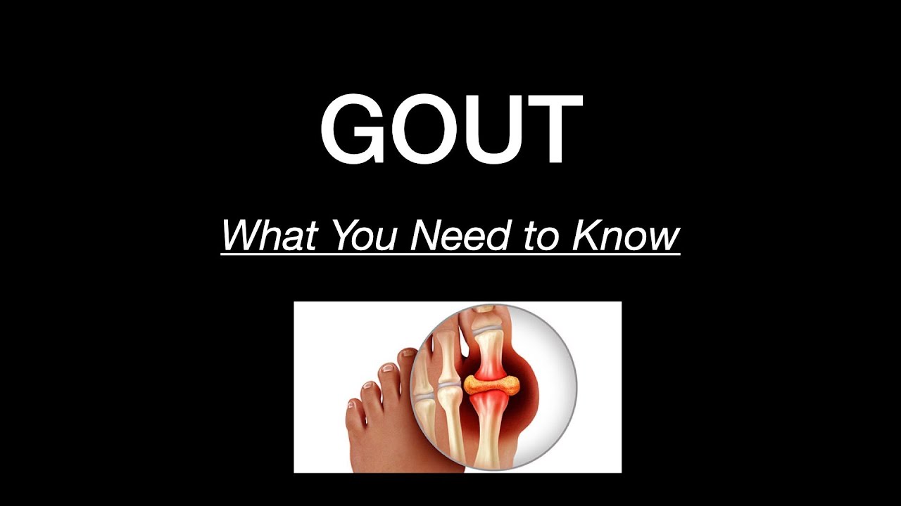 Beat Gout Forever With These Doctor-Approved Tips