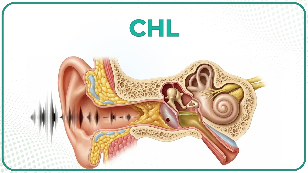 Conductive Hearing loss 🦻🔊: ENT Lecture
