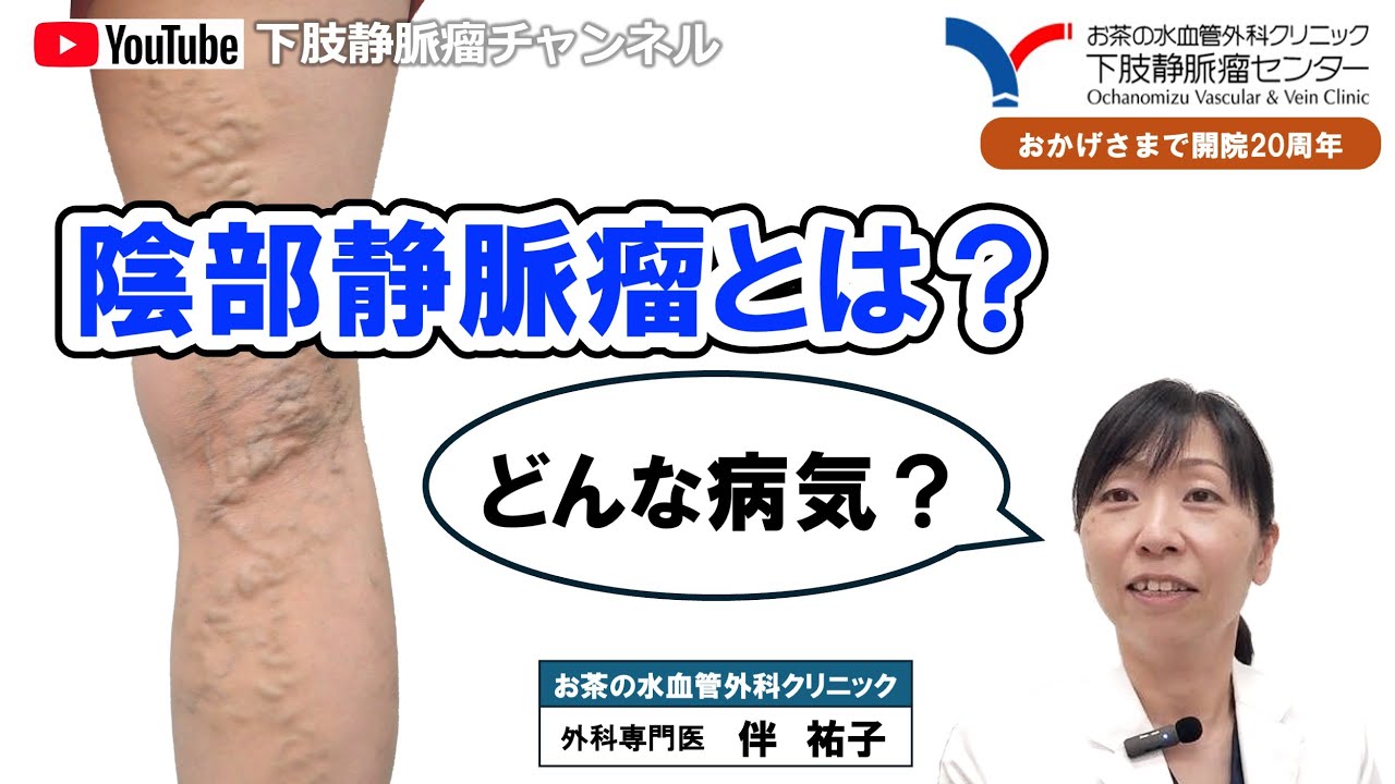 【下肢静脈瘤とは｜お茶クリチャンネル】開院20周年の下肢静脈瘤専門クリニック。下肢静脈瘤・足のむくみのことなら当院にお任せください。