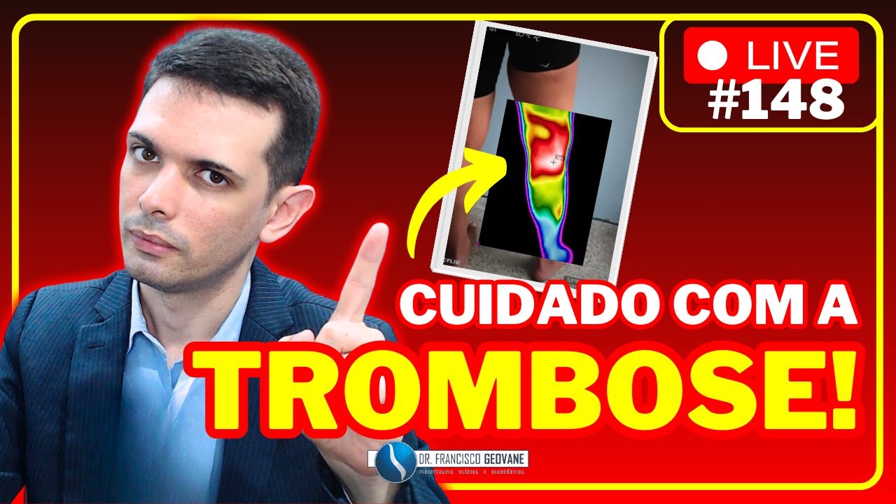 🚨 O que Causa TROMBOSE na PERNA? E que CUIDADOS PRECISAMOS TER?