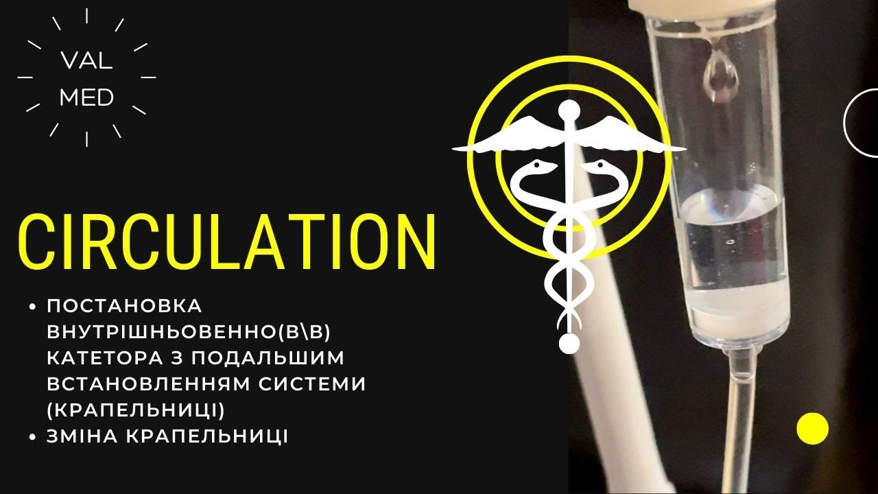 Внутрішньовенний доступ. Крапельниця. Система. Circulation