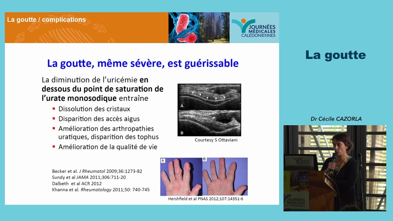 La goutte