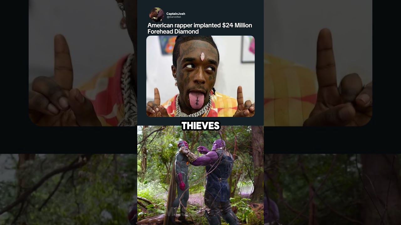 lil uzi vert forehead diamond 💀
