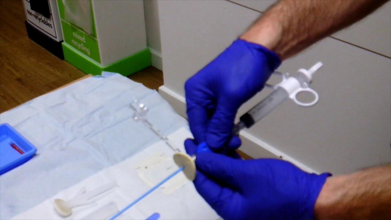 Pleural Fluid Aspiration