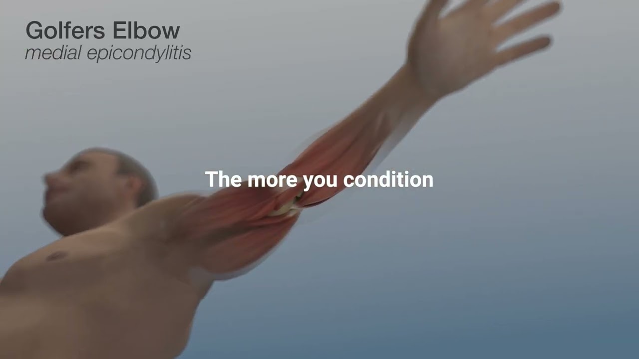 How does stretching prevent injuries? (StretchMED)