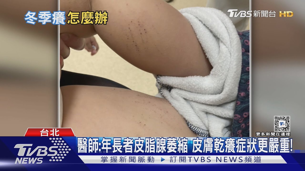 皮膚脫皮.龜裂.乾燥....醫警告:千萬別做「這件事」...後果難以想像....｜十點不一樣20250117 @TVBSNEWS01