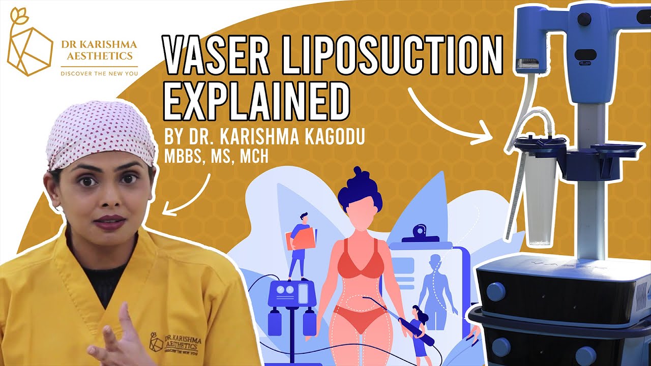 Vaser High Definition Liposuction India | Best Explained | Dr. Karishma Aesthetics, Bengaluru, India