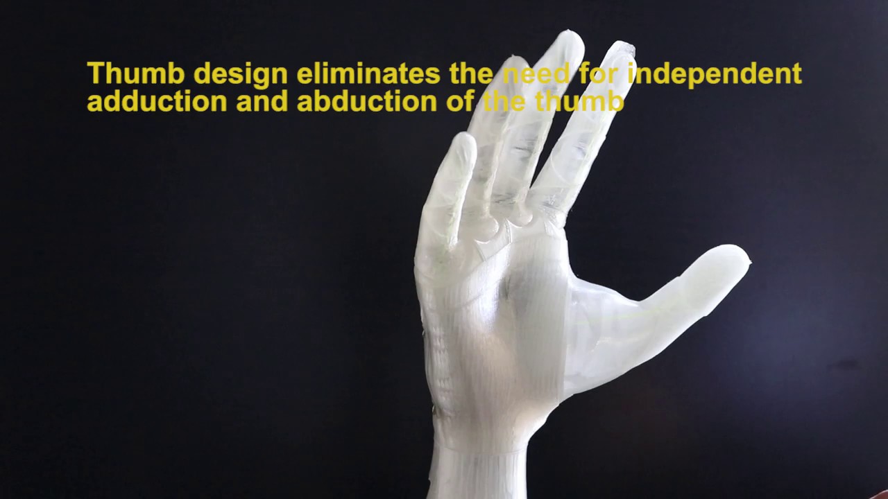 X-Limb - A Lightweight Soft Robotic Prosthetic Hand