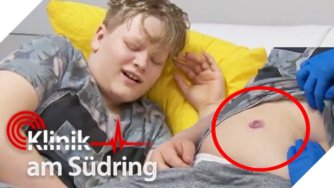 NOTFALL-OP! Ärzte finden beim Schüler einen Nabelbruch | Klinik am Südring | SAT.1