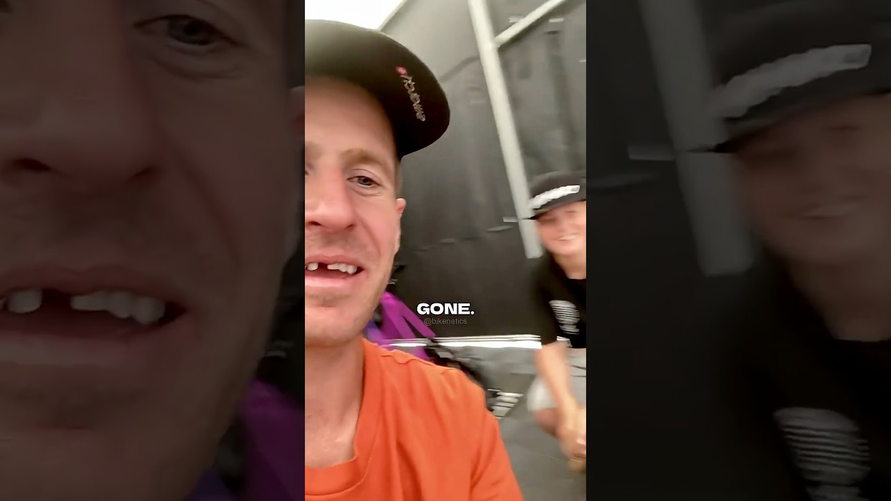How Sam Pilgrim Lost His Tooth 🦷