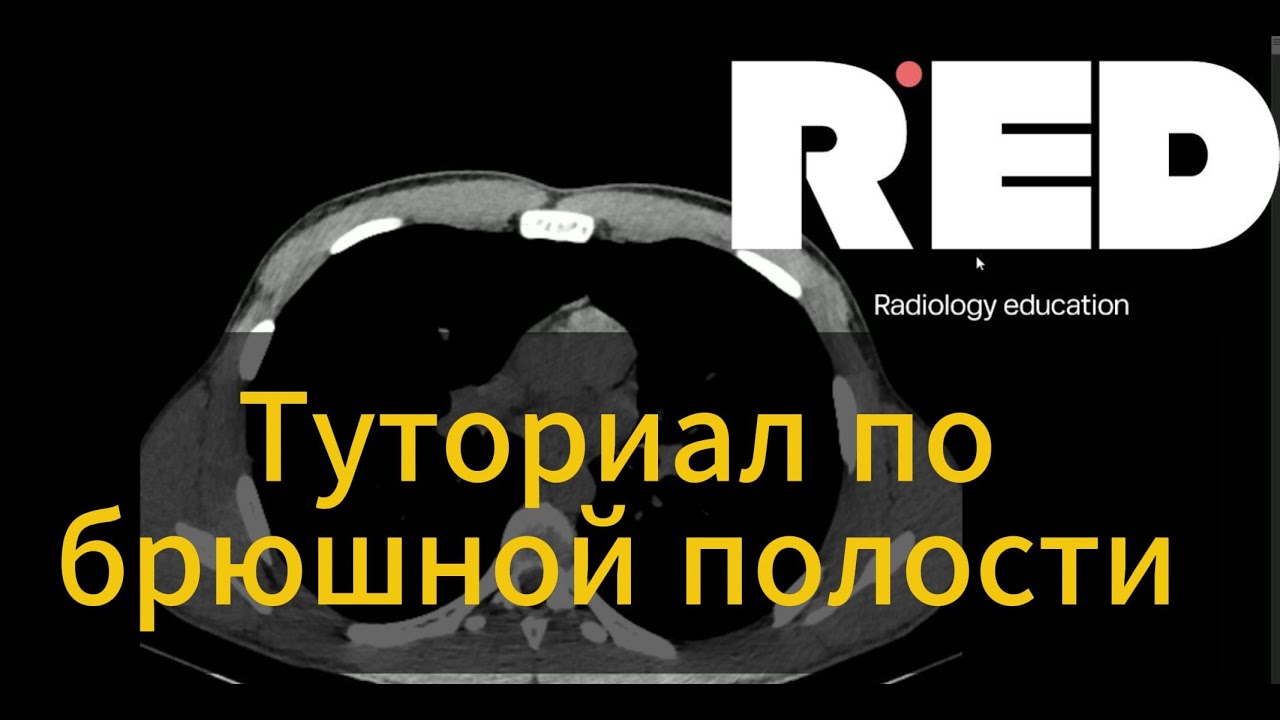 Туториал для молодых специалистов, куда смотреть при описании брюшной полости.