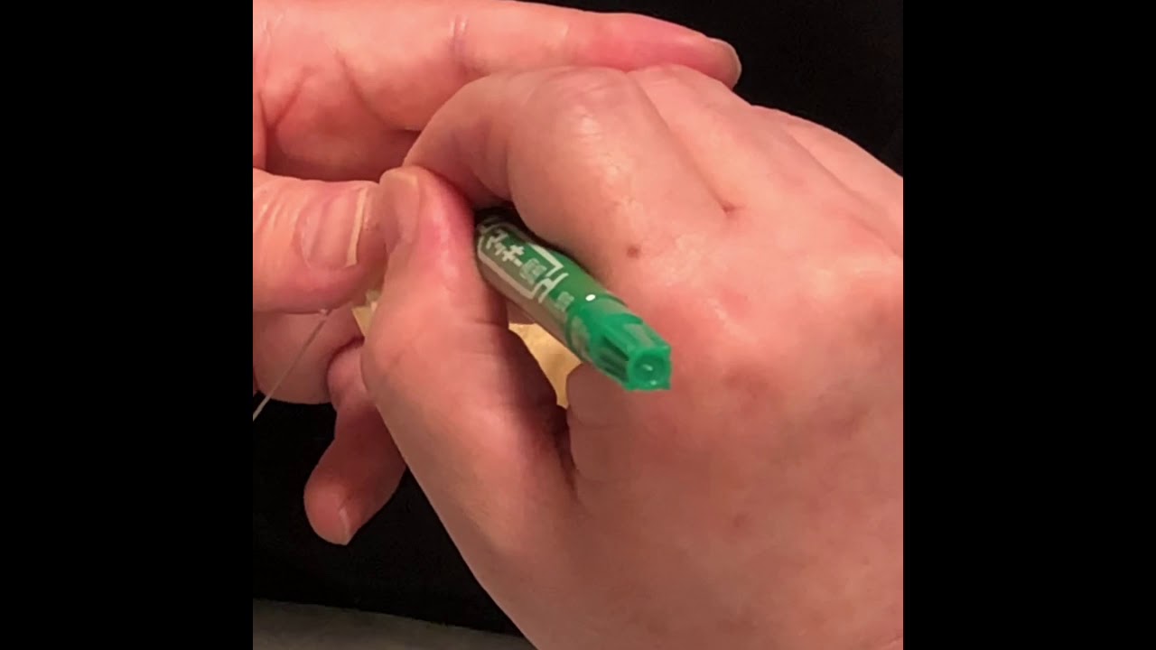 ふなつデンタルクリニック　ワイヤーべンディング