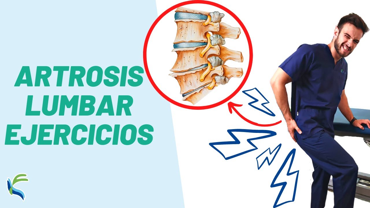 ARTROSIS LUMBAR ejercicios y estiramientos para el DOLOR | Fisiolution