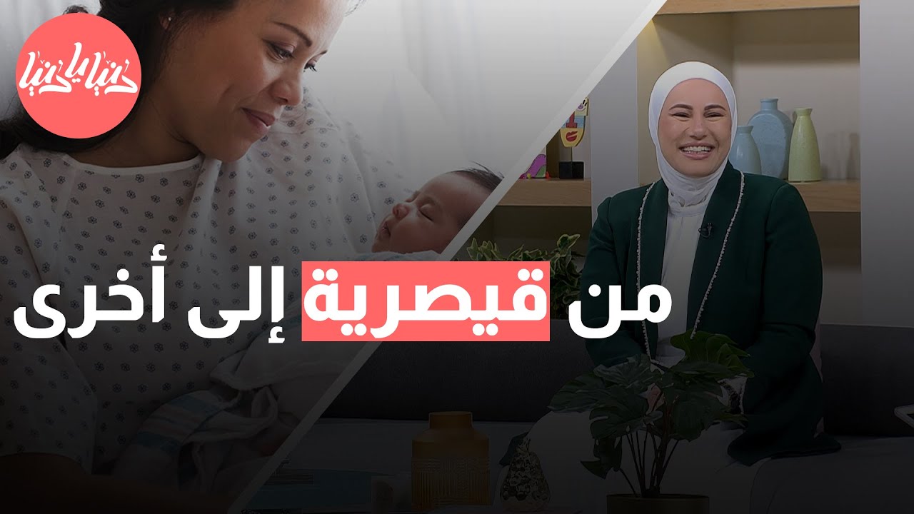 الولادات القيصرية المتكررة: هل تمثل خطرًا على صحة الأم؟
