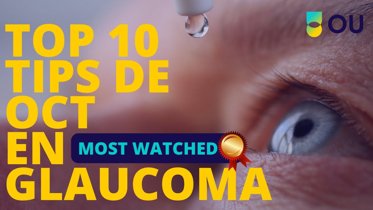 Top 10 Tips de OCT en Glaucoma
