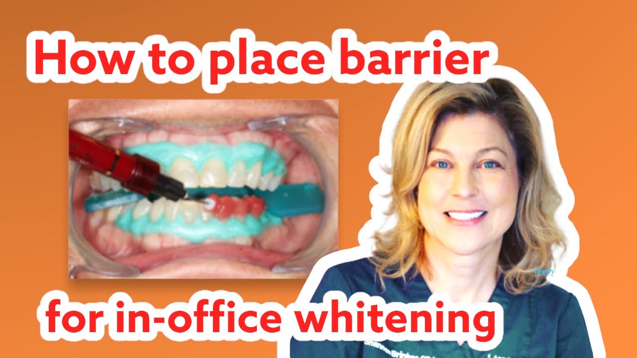 How to place gingival barrier for in office whitening procedures
