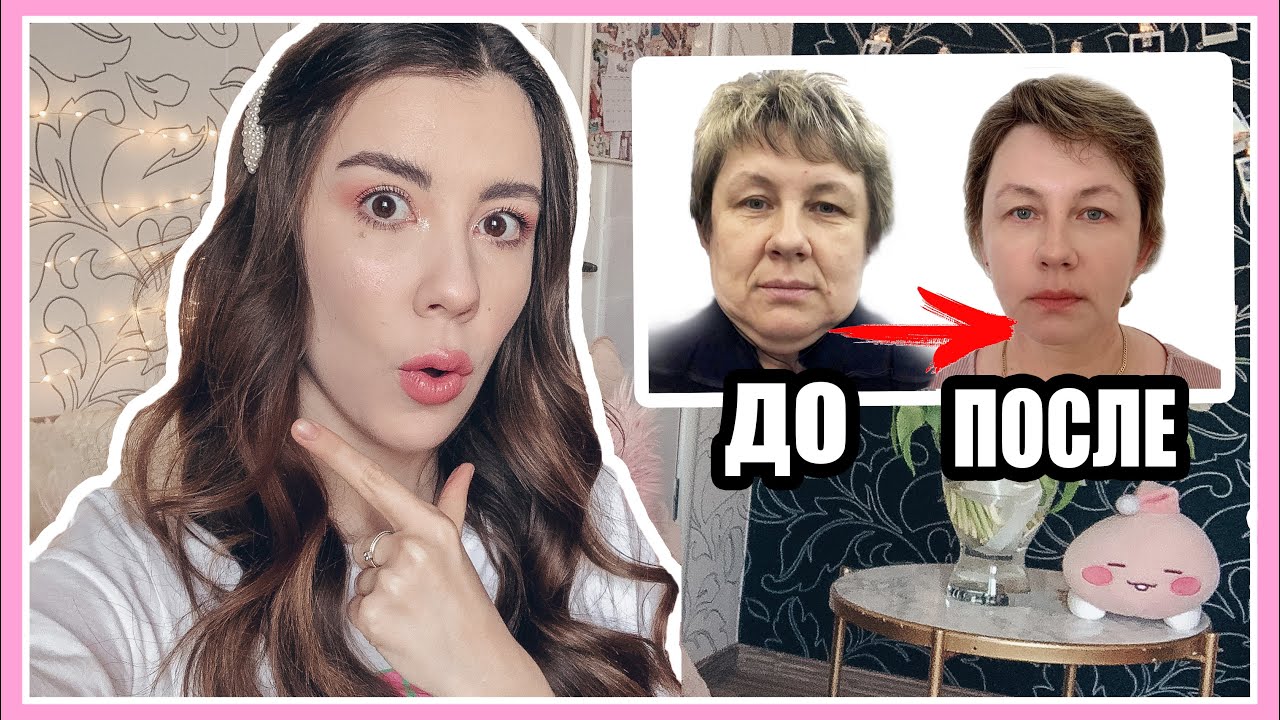 МОЯ ПЛАСТИЧЕСКАЯ ОПЕРАЦИЯ В КОРЕЕ 🤒🏩 ВО ВРЕМЯ И ПОСЛЕ ОПЕРАЦИИ 🇰🇷 СЕУЛ