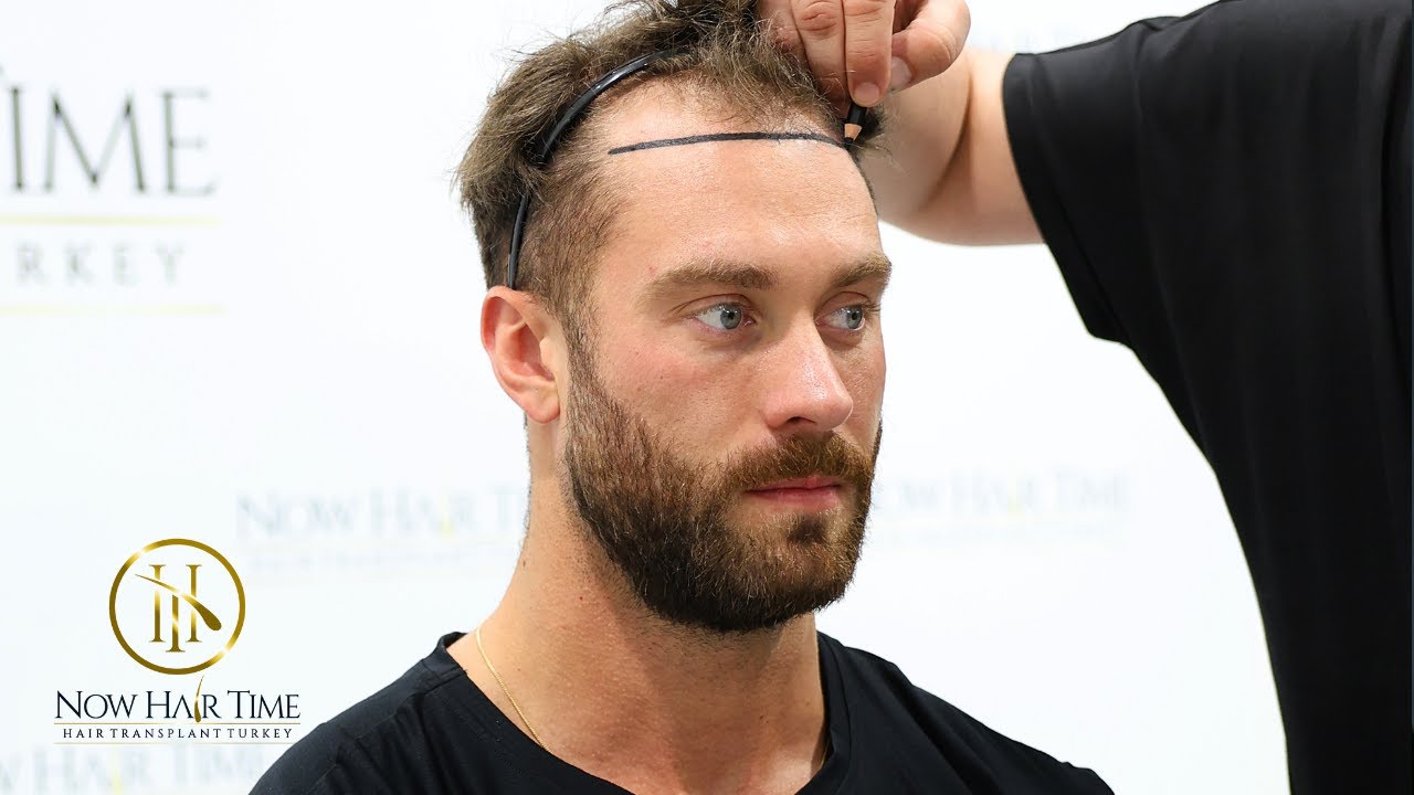 Classic Physique Mr. Olympia x5 champion Chris Bumstead chooses Now Hair Time @ChrisBumstead
