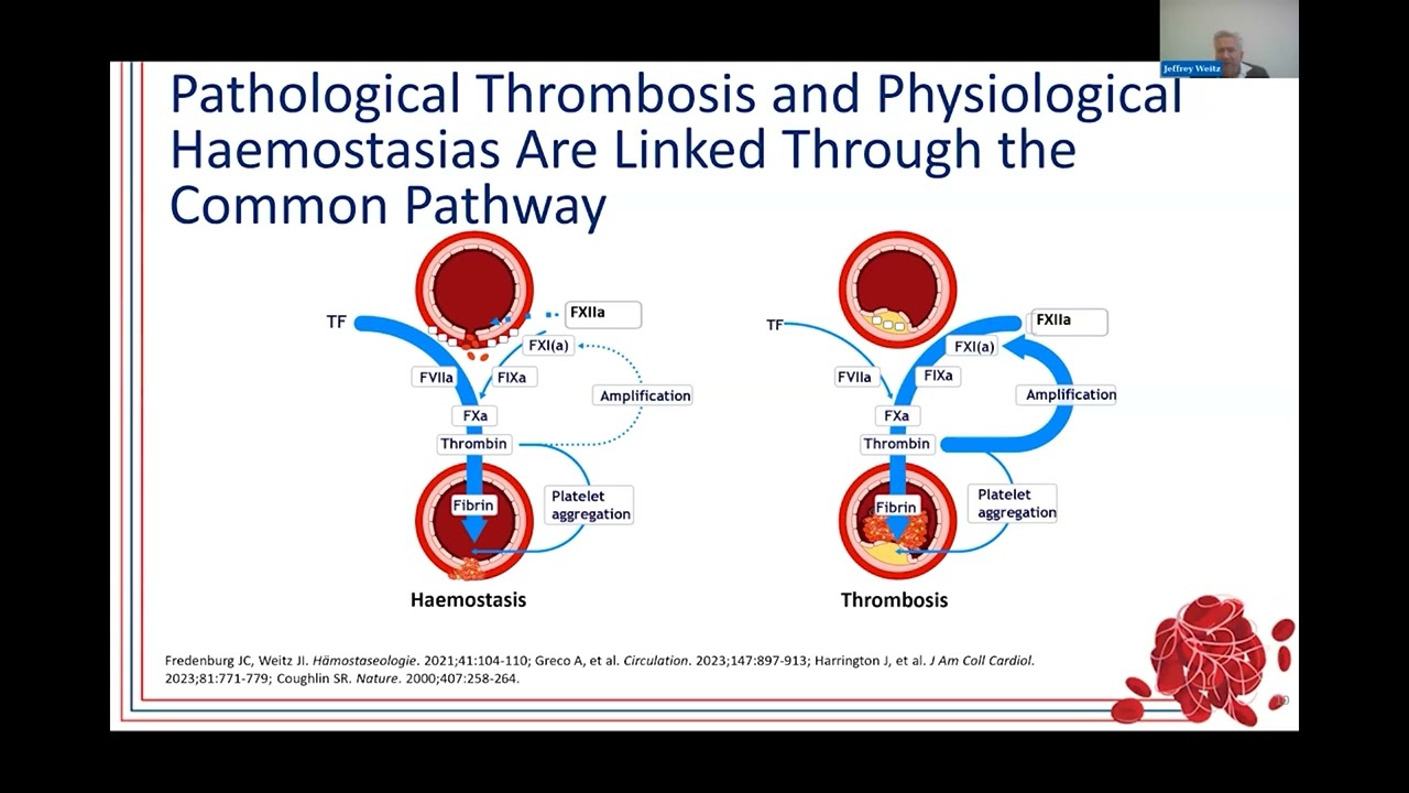 Factor XI/XIa Inhibition: Ensuring Safety and Efficacy