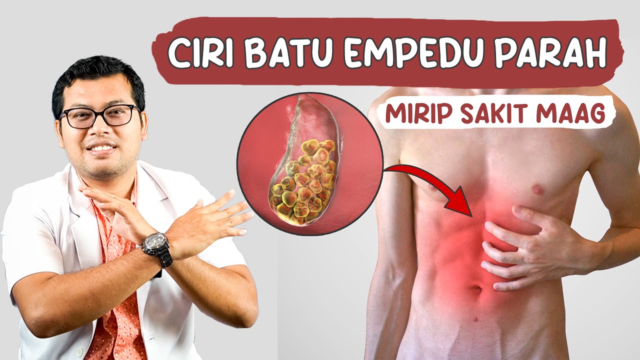 TANDA SAKIT BATU EMPEDU YANG PARAH - DOKTER SADDAM ISMAIL