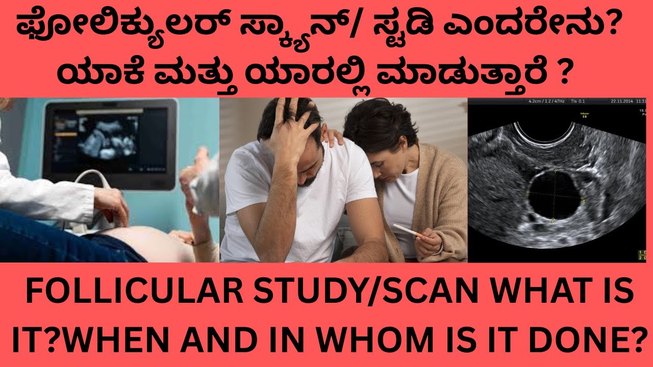 FOLLICULAR STUDY IN KANNADA.FOLLICULAR STUDY WHY  HOW AND IN WHOM IS IT DONE IN KANNADA